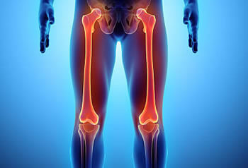 Knee Total Replacement - Dr Punjabi - Wollongong, Sydney